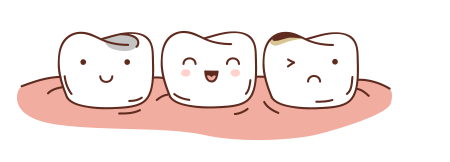 fillings.png